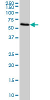 FGL2 monoclonal antibody (M01), clone 6D9 Western blot of FGL2 expression in HeLa.