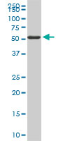 FGL2 monoclonal antibody (M01), clone 6D9. Western blot of FGL2 expression in PC-12.