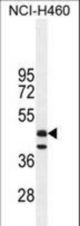 FGL2 Antibody western blot of NCI-H460 cell line lysates (35 ug/lane). The FGL2 antibody detected the FGL2 protein (arrow).