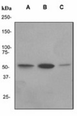 Western blot analysis on (A) HL-60 treated with Retinoic acid (B) Raji and (C) PBMC cell lysates using anti-FGR antibody (LS-C105578).
