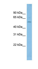 FGR antibody LS-C116584 Western blot of U937 cell lysate.