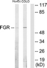 Western blot of extracts from HUVEC/COLO205 cells, using FGR Antibody. The lane on the right is treated with the synthesized peptide.