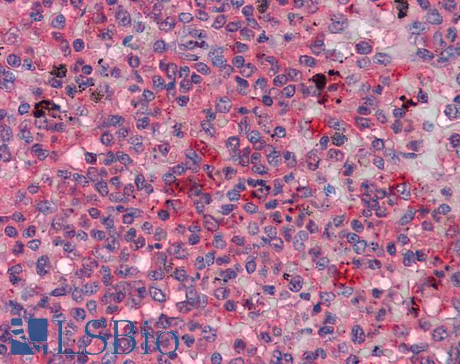 Anti-FGR antibody IHC of human spleen. Immunohistochemistry of formalin-fixed, paraffin-embedded tissue after heat-induced antigen retrieval. Antibody LS-B4106 dilution 1:200.