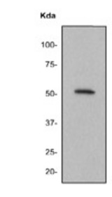 Western blot analysis on Raji cell lysate using anti-Fgr antibody.
