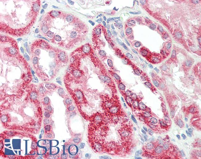 Human Kidney: Formalin-Fixed, Paraffin-Embedded (FFPE)