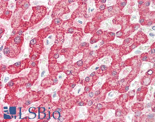 Human Liver: Formalin-Fixed, Paraffin-Embedded (FFPE)