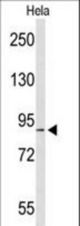 Western blot of COG2 Antibody in HeLa cell line lysates (35 ug/lane). COG2 (arrow) was detected using the purified antibody.
