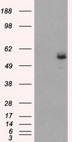 HEK293T cells were transfected with the pCMV6-ENTRY control (Left lane) or pCMV6-ENTRY FH (Right lane) cDNA for 48 hrs and lysed. Equivalent amounts of cell lysates (5 ug per lane) were separated by SDS-PAGE and immunoblotted with anti-FH.