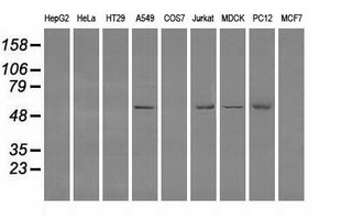 Western blot of extracts (35 ug) from 9 different cell lines by using anti-FH monoclonal antibody.