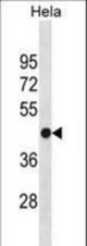 FH Antibody western blot of HeLa cell line lysates (35 ug/lane). The FH Antibody detected the FH protein (arrow).