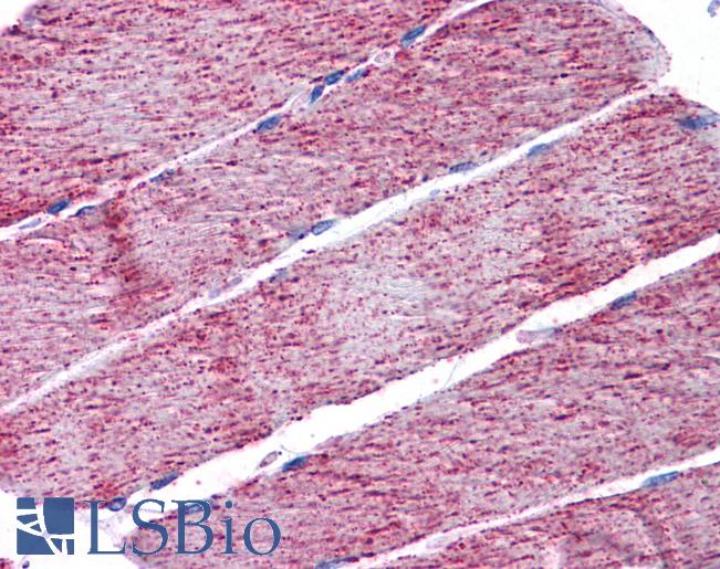 Anti-FH / Fumarase antibody IHC of human skeletal muscle. Immunohistochemistry of formalin-fixed, paraffin-embedded tissue after heat-induced antigen retrieval. Antibody LS-B4937 concentration 3.75 ug/ml.