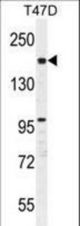 FHAD1 Antibody western blot of T47D cell line lysates (35 ug/lane). The FHAD1 antibody detected the FHAD1 protein (arrow).