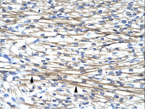 FHL2 antibody LS-C30542 was used in IHC to stain formalin-fixed, paraffin-embedded human heart.