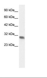 Fetal Heart Lysate