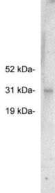 Western blot of LS-C26926, rabbit polyclonal at 0.5 ug/ml on HeLa cell extract (10 ug/lane). Blots were developed with goat anti-rabbit Ig (1:75k) and Pierce Supersignal West Femto system.