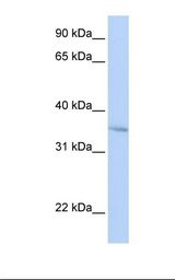 HepG2 cell lysate. Antibody concentration: 1.0 ug/ml. Gel concentration: 12%.