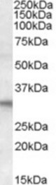 FHL2 antibody (1 ug/ml) staining of Human Heart lysate (35 ug protein/ml in RIPA buffer). Primary incubation was 1 hour. Detected by chemiluminescence.
