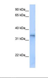 Placenta cell lysate. Antibody concentration: 0.5 ug/ml. Gel concentration: 12%.