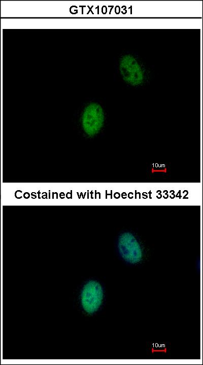 Immunofluorescence of paraformaldehyde-fixed HeLa using FHL5 antibody at 1:500 dilution.