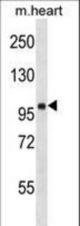 FHOD1 Antibody western blot of mouse heart tissue lysates (35 ug/lane). The FHOD1 antibody detected the FHOD1 protein (arrow).