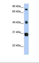 Fetal lung lysate. Antibody concentration: 1.0 ug/ml. Gel concentration: 12%.