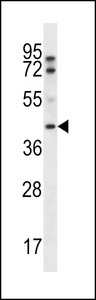 FIBP Antibody western blot of A2058 cell line lysates (35 ug/lane). The FIBP antibody detected the FIBP protein (arrow).