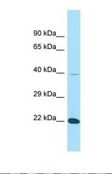Western blot of Human THP-1. FIBP antibody dilution 1.0 ug/ml.