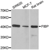 Western blot analysis of extracts of various cell lines, using FIBP antibody.
