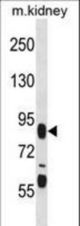 FIGN Antibody western blot of mouse kidney tissue lysates (35 ug/lane). The FIGN antibody detected the FIGN protein (arrow).