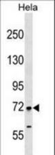 FIGNL1 Antibody western blot of HeLa cell line lysates (35 ug/lane). The FIGNL1 antibody detected the FIGNL1 protein (arrow).