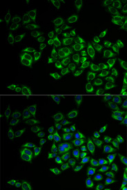 Immunofluorescence analysis of MCF-7 cell using FIS1 antibody. Blue: DAPI for nuclear staining.