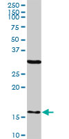FIS1 monoclonal antibody (M01), clone 1G9. Western blot of FIS1 expression in human liver.
