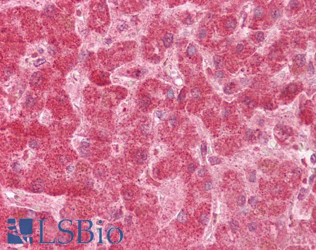 Anti-FIS1 antibody IHC of human liver. Immunohistochemistry of formalin-fixed, paraffin-embedded tissue after heat-induced antigen retrieval. Antibody LS-B6502 concentration 5 ug/ml.