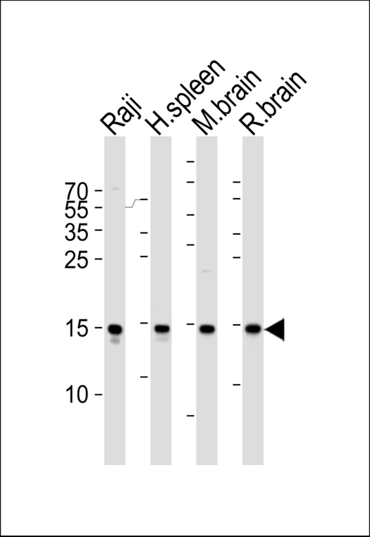 Western blot of lysates from Raji cell line, human spleen, mouse brain and rat brain tissue lysate (from left to right) with FIS1 Antibody. Antibody was diluted at 1:1000 at each lane. A goat anti-rabbit IgG H&L (HRP) at 1:5000 dilution was used as the secondary antibody. Lysates at 35 ug per lane.