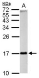 TTC11 antibody detects FIS1 protein by Western blot analysis. A. 50 ug rat brain lysate/extract. 15 % SDS-PAGE. TTC11 antibody dilution:1:1000