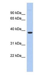FITM1 antibody Western Blot of LOC161247 Antibody validated by WB using Fetal liver cell lysate at 0.2-1 ug/ml.
