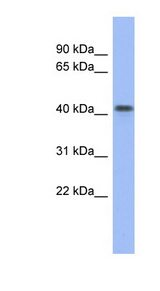 FIZ1 antibody LS-C109549 Western blot of Fetal Small Intestine lysate.