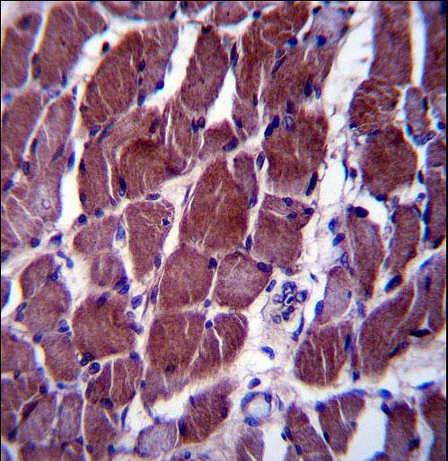 FIZ1 Antibody immunohistochemistry of formalin-fixed and paraffin-embedded human skeletal muscle followed by peroxidase-conjugated secondary antibody and DAB staining.