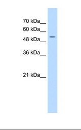 Jurkat cell lysate. Antibody concentration: 0.5 ug/ml. Gel concentration: 12%.