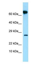 FKBP10 / FKBP65 antibody Western Blot of Placenta.