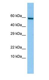 FKBP10 / FKBP65 antibody Western Blot of PANC1 cell lysate. FKBP10 is supported by BioGPS gene expression data to be expressed in PANC1.