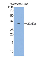 Western blot of recombinant FKBP10 / FKBP65.