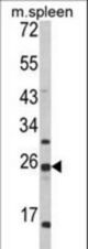 Western blot of FKBP11 Antibody in mouse spleen tissue lysates (35 ug/lane). FKBP11 (arrow) was detected using the purified antibody.