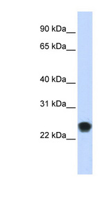 FKBP11 antibody LS-C102262 Western blot of Transfected 293T cell lysate.