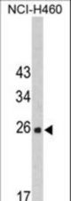 Western blot of FKBP14 Antibody in NCI-H460 cell line lysates (35 ug/lane). FKBP14 (arrow) was detected using the purified antibody.