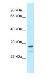 FKBP14 antibody Western Blot of HeLa.