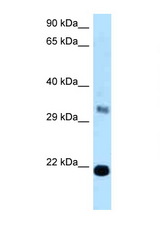 FKBP14 antibody LS-C145945 Western blot of Fetal Liver lysate. Antibody concentration 1 ug/ml.