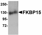 Western blot of FKBP15 in 3T3 cell lysate with FKBP15 antibody at 1 ug/ml. Below: Immunohistochemistry of FKBP15 in mouse brain tissue with FKBP15 antibody at 2.5 ug/ml.