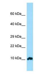 FKBP1A / FKBP12 antibody Western Blot of Placenta.