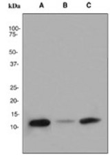 Western blot analysis on (A) fetal brain, (B) U937 and (C) SH-SY5Y cell lysates using anti-FKBP12 antibody (LS-C105744).